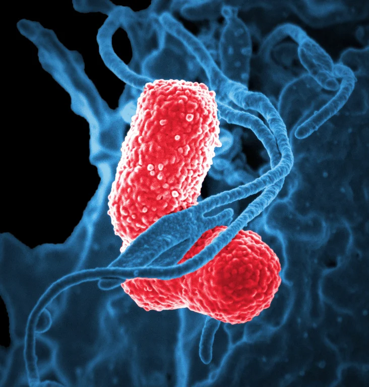 Scanning electron micrograph of oral bacteria associated with oral cancer research